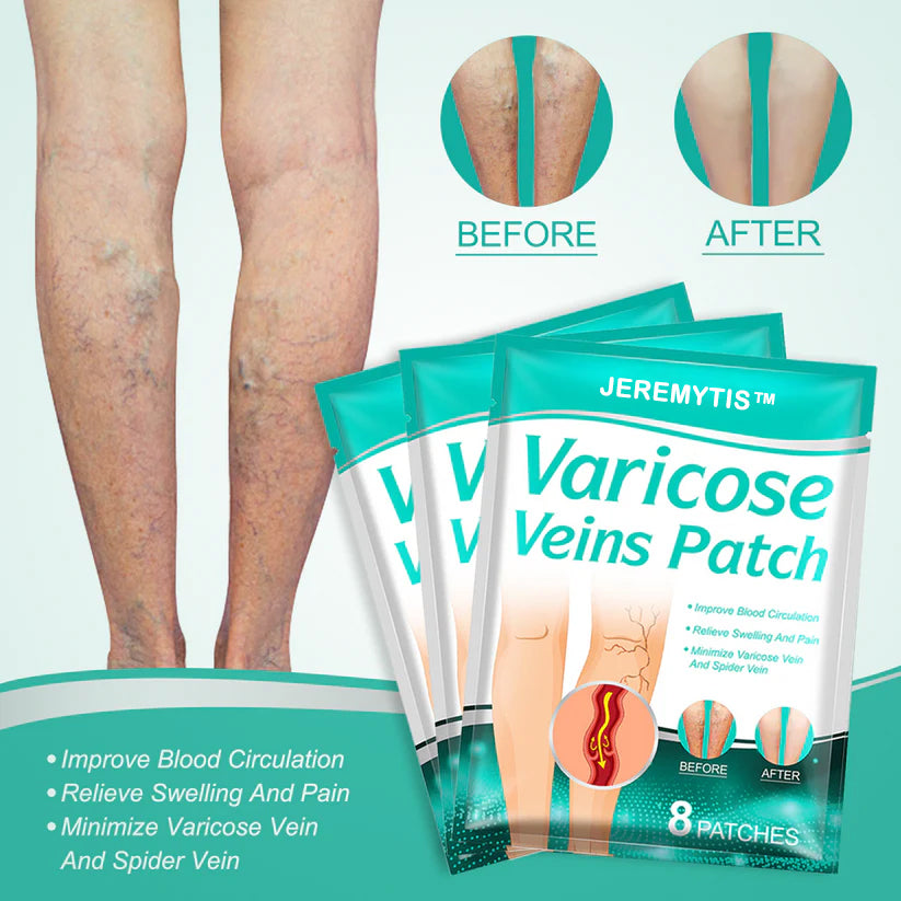 ✨ Last Day Discount: 80% OFF 🌸 JEREMYTIS™ Leech Varicose Veins Patch