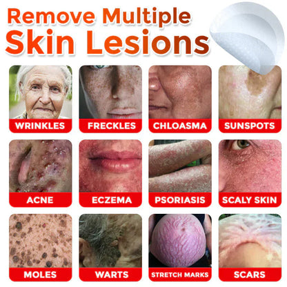 🌈 MicroNeedle Botanic Skin Tag Removal Patch (Made in the USA)