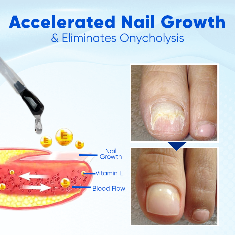 JEREMYTIS™ OnyxoGuard Nail Growth and Repair Serum