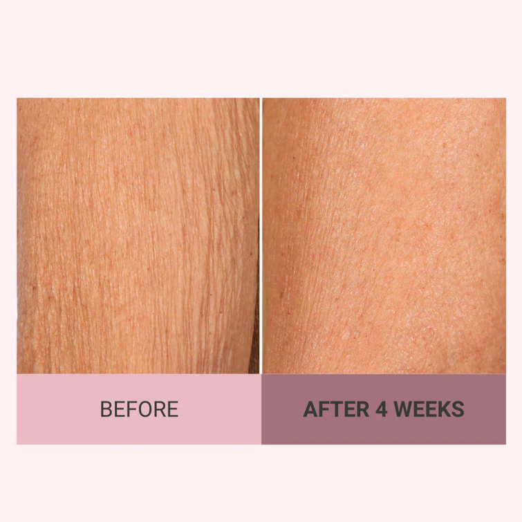 💆‍♀️ Experience Ultimate Luxury - 50% OFF - ✨ Champagne Beaute Lift Firming Body Cream - For Firmer, Smoother, Radiant Skin! 🌟（Buy 3 & Free Shipping）