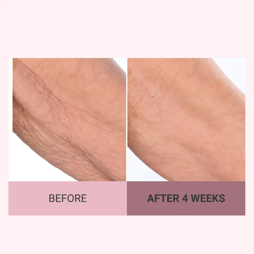 💆‍♀️ Experience Ultimate Luxury - 50% OFF - ✨ Champagne Beaute Lift Firming Body Cream - For Firmer, Smoother, Radiant Skin! 🌟（Buy 3 & Free Shipping）